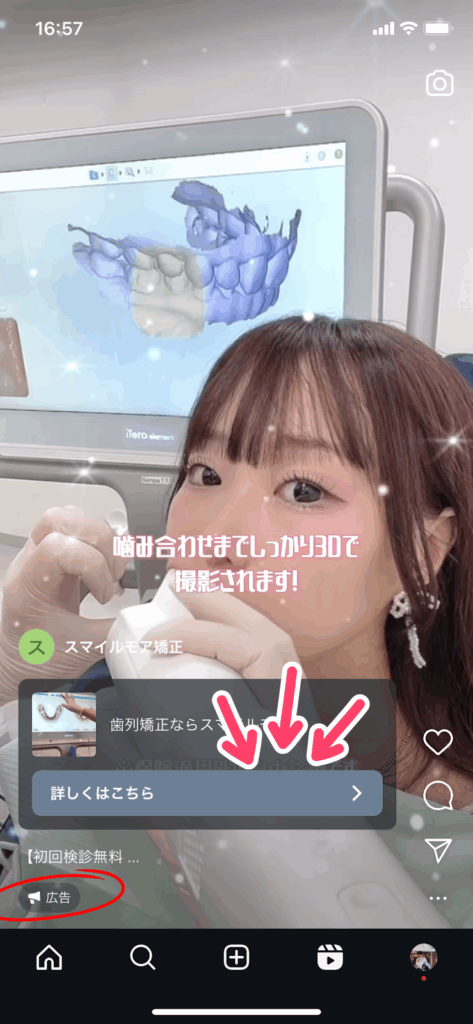 oh my teeth 6ヶ月無料